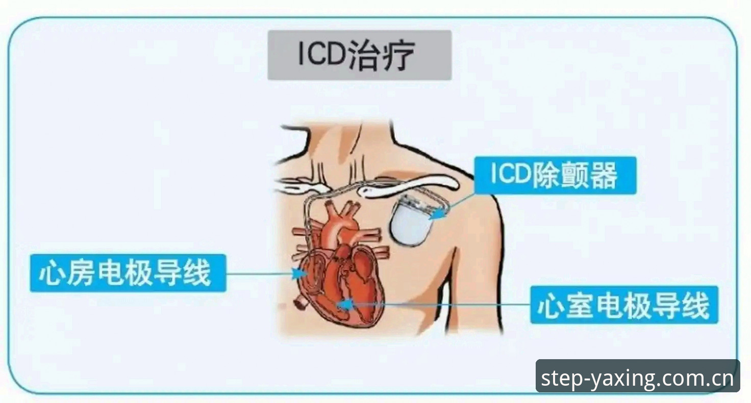 埃里克森五次倒下，这款除颤器性能如何？亚星体育平台深度评测